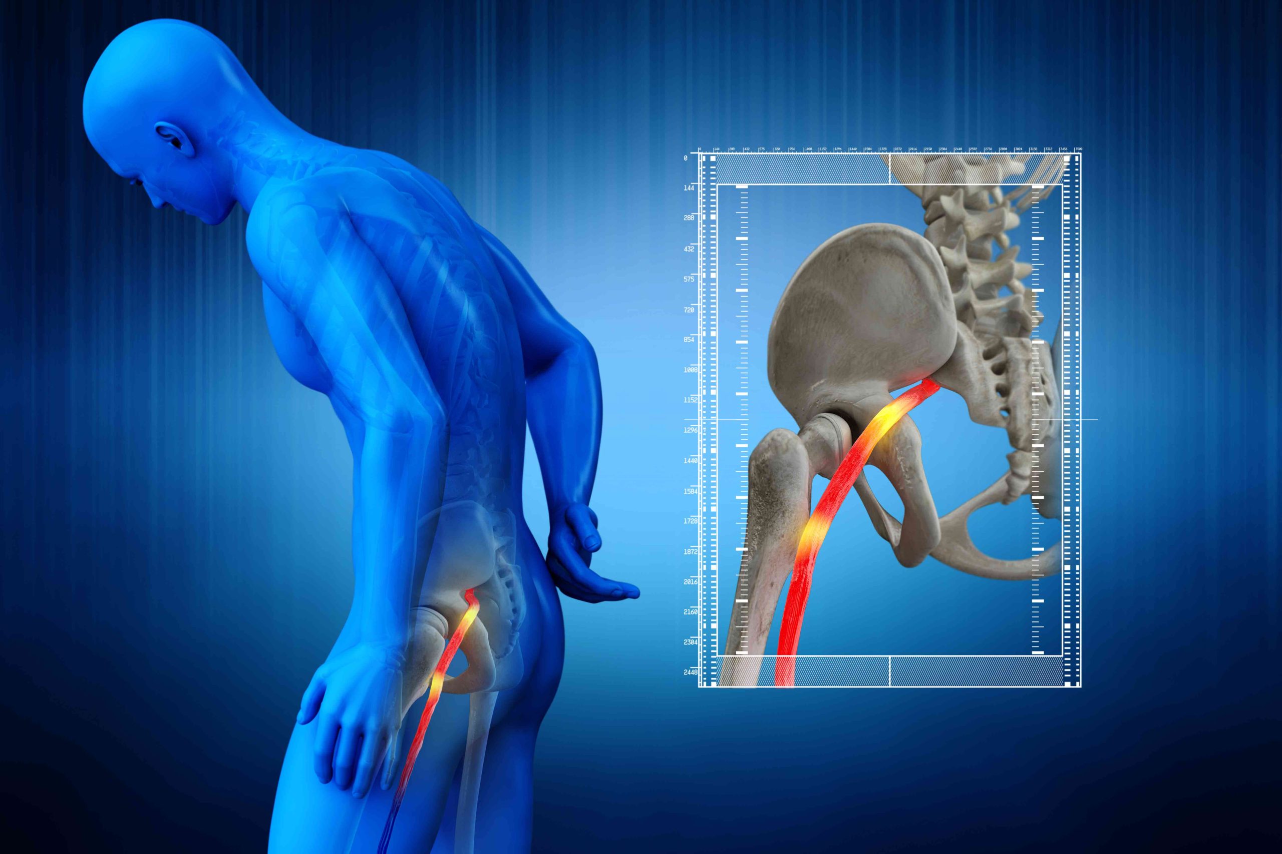 image showing the sciatic nerve which runs down the leg