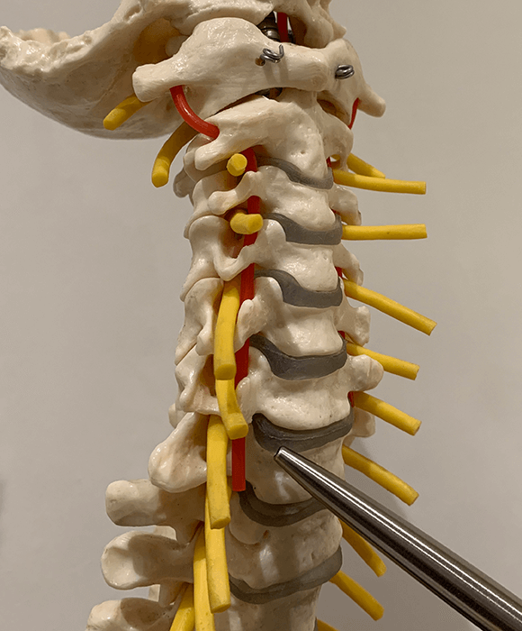 image pointing to disc in the neck on anatomy model