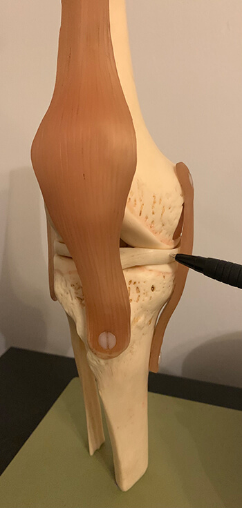Image pointing to the knee meniscus on a model of the knee