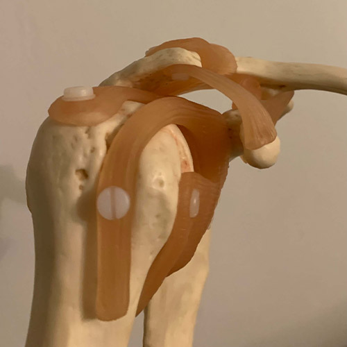 Joints Prolotherapy