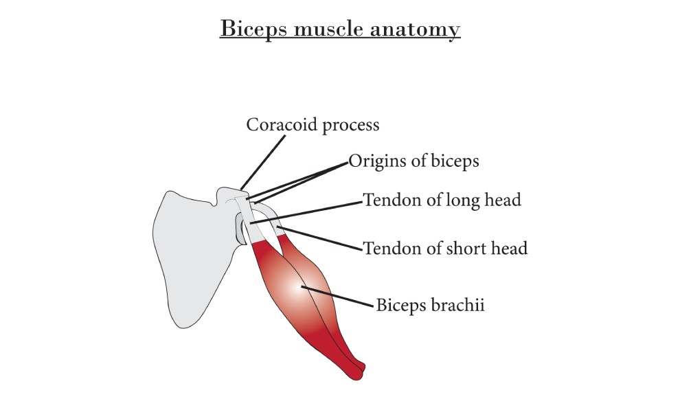 Biceps tendonitis is a condition that involves inflammation or irritation of the biceps tendon, which connects the biceps muscle to the shoulder and elbow joints. 
