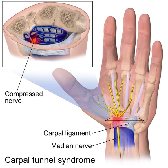 Anatomy and diagram for carpal tunnel syndrome