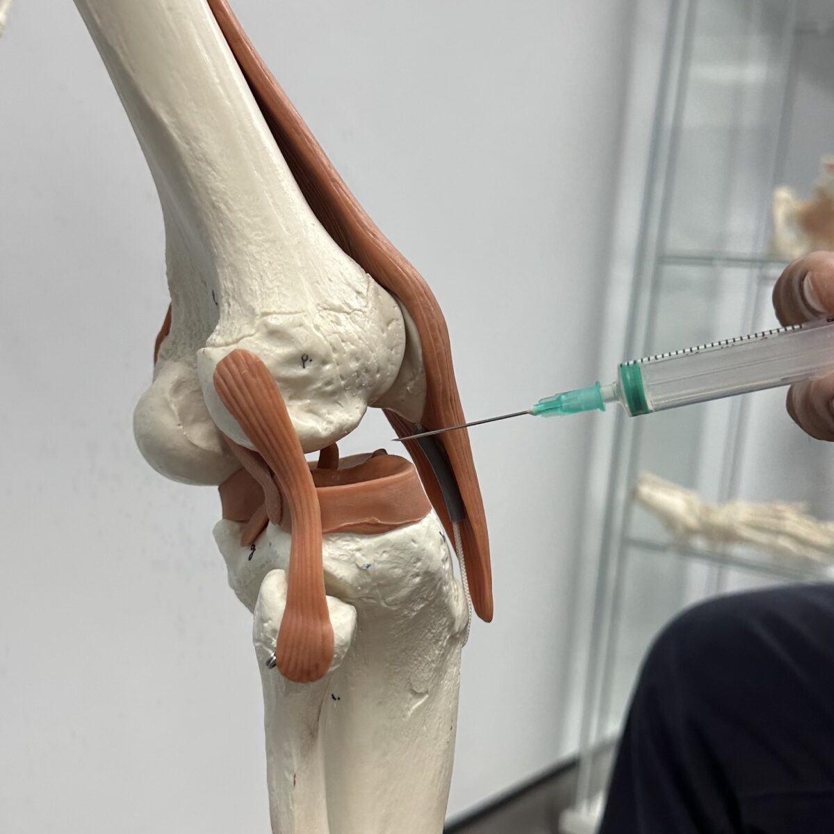 Image showing Ostenil injected into model of a Knee