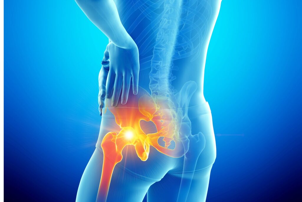 Most Common Causes of Hip Pain and How to Treat Them